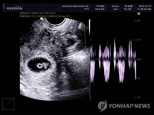 임신부 초음파 사진